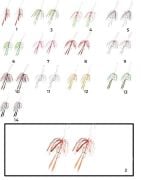 Hayabusa SE 125 Tai Rubber Free Slide Yedek Etekli Assist İğne Set